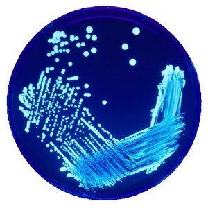 Colonies de légionelles dans une boîte de Petri observée en fluorescence